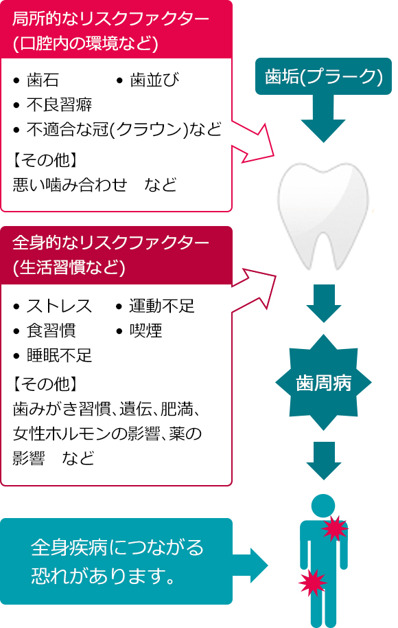 歯周病の間接的原因＝リスクファクター(危険因子)