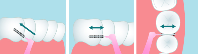 歯間用ブラシを水平にし、歯の面に合わせて前後に2〜3回動かします。奥歯は歯の内側からと外側から、両方行いましょう。